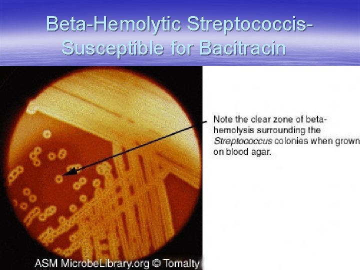 Beta-Hemolytic Streptococcis. Susceptible for Bacitracin 