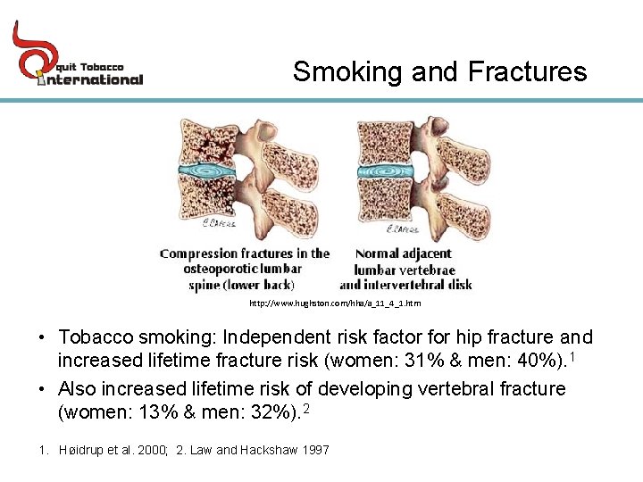 Smoking and Fractures http: //www. hughston. com/hha/a_11_4_1. htm • Tobacco smoking: Independent risk factor