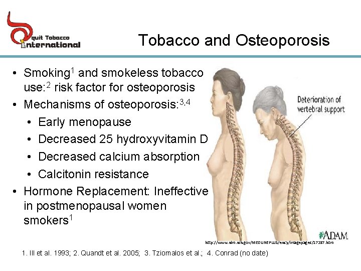 Tobacco and Osteoporosis • Smoking 1 and smokeless tobacco use: 2 risk factor for