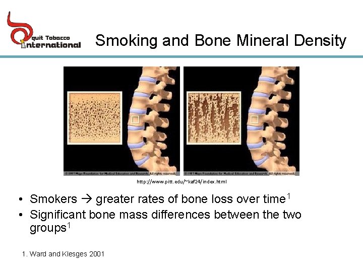 Smoking and Bone Mineral Density http: //www. pitt. edu/~kaf 24/index. html • Smokers greater
