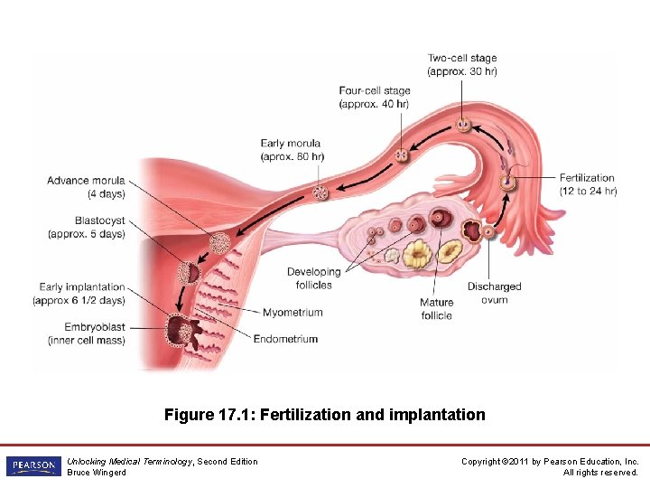 Figure 17. 1: Fertilization and implantation Unlocking Medical Terminology, Second Edition Bruce Wingerd Copyright