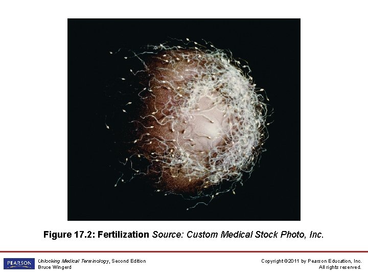 Figure 17. 2: Fertilization Source: Custom Medical Stock Photo, Inc. Unlocking Medical Terminology, Second