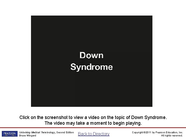 Down Syndrome Video Click on the screenshot to view a video on the topic