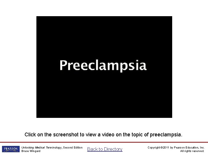 Preeclampsia Video Click on the screenshot to view a video on the topic of