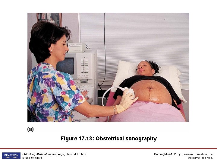 Figure 17. 18: Obstetrical sonography Unlocking Medical Terminology, Second Edition Bruce Wingerd Copyright ©