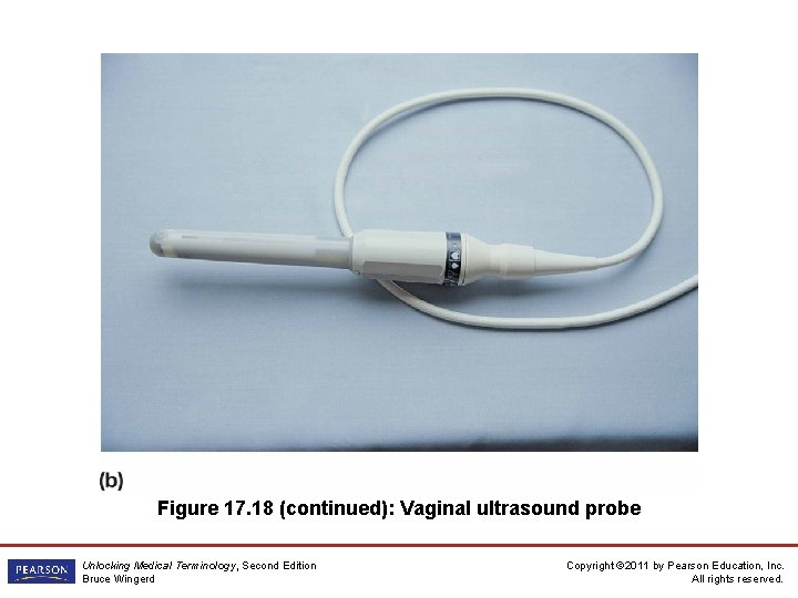 Figure 17. 18 (continued): Vaginal ultrasound probe Unlocking Medical Terminology, Second Edition Bruce Wingerd