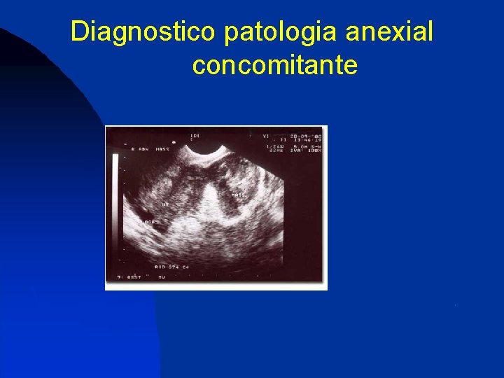 Diagnostico patologia anexial concomitante 