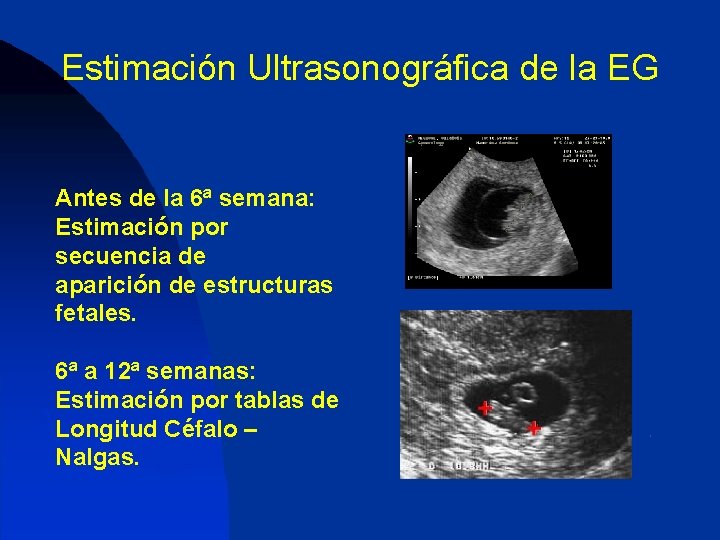 Estimación Ultrasonográfica de la EG Antes de la 6ª semana: Estimación por secuencia de