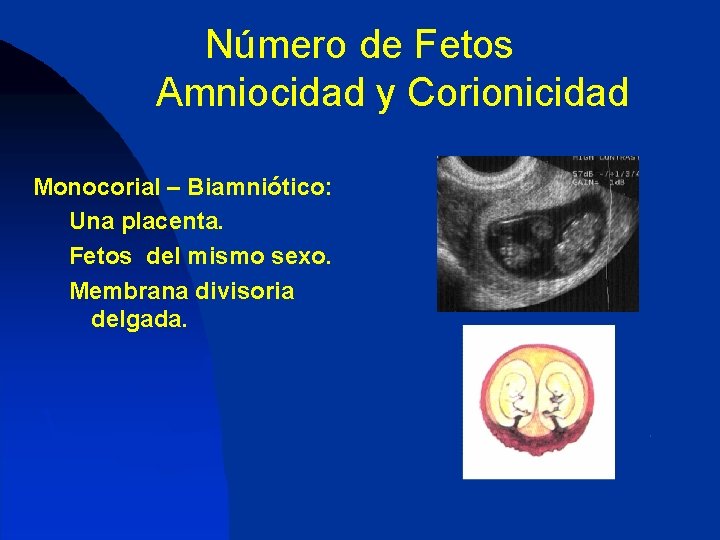 Número de Fetos Amniocidad y Corionicidad Monocorial – Biamniótico: Una placenta. Fetos del mismo