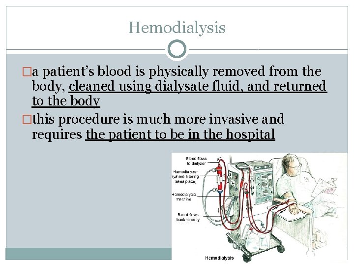 Hemodialysis �a patient’s blood is physically removed from the body, cleaned using dialysate fluid,