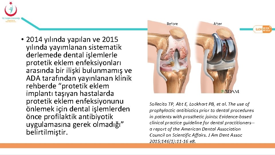  • 2014 yılında yapılan ve 2015 yılında yayımlanan sistematik derlemede dental işlemlerle protetik