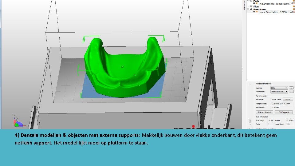 4) Dentale modellen & objecten met externe supports: Makkelijk bouwen door vlakke onderkant, dit