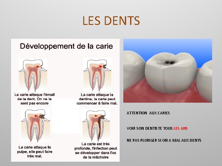 LES DENTS ATTENTION AUX CARIES VOIR SON DENTISTE TOUS LES ANS NE PAS PLONGER