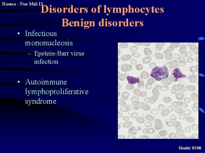 Haema - Non Mal: 13 Disorders of lymphocytes Benign disorders • Infectious mononucleosis –