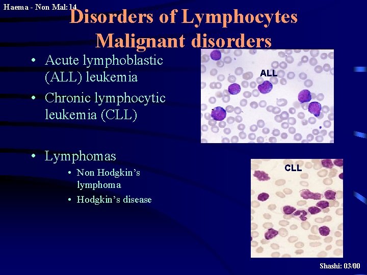Haema - Non Mal: 14 Disorders of Lymphocytes Malignant disorders • Acute lymphoblastic (ALL)