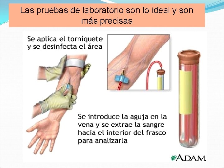 Las pruebas de laboratorio son lo ideal y son más precisas Las pruebas de laboratorio son lo ideal y son más precisas