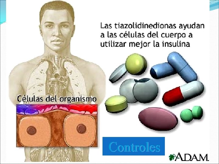 Controles Controles