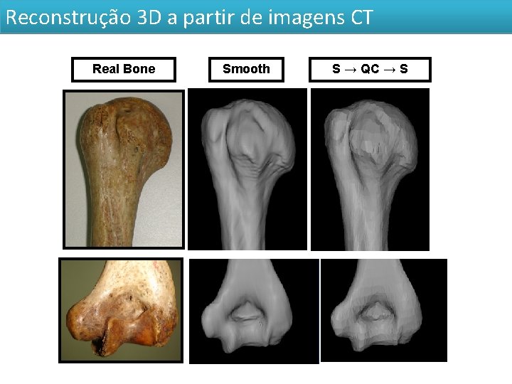 Reconstrução 3 D a partir de imagens CT Real Bone Smooth S → QC