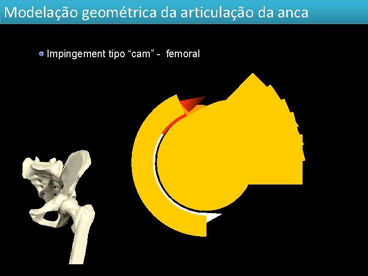 Modelação geométrica da articulação da anca Impingement tipo “cam” - femoral 