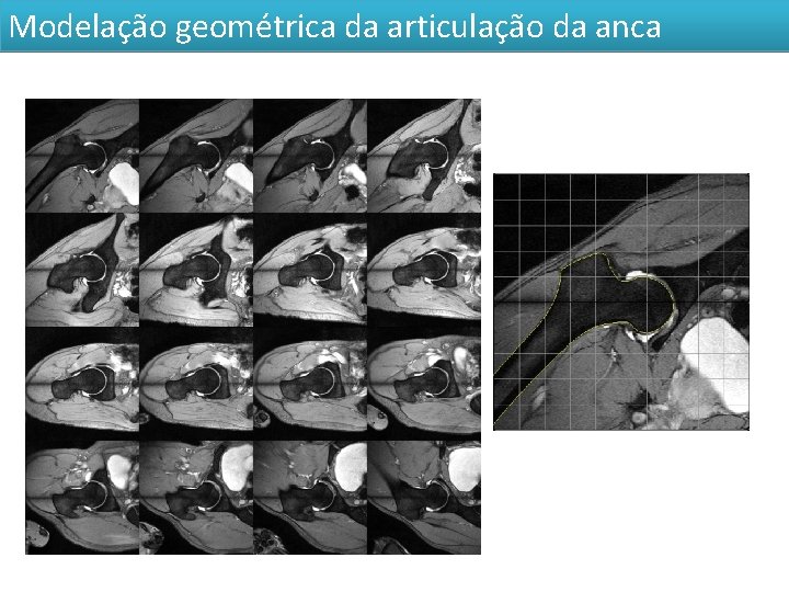 Modelação geométrica da articulação da anca 