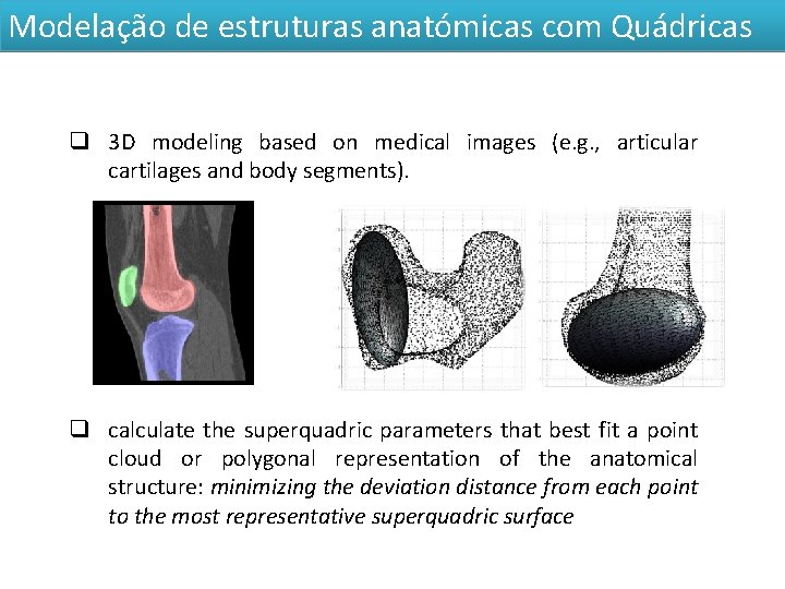Modelação de estruturas anatómicas com Quádricas q 3 D modeling based on medical images