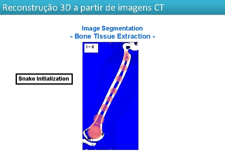 Reconstrução 3 D a partir de imagens CT Image Segmentation - Bone Tissue Extraction
