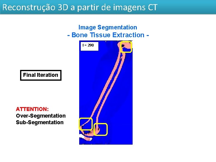 Reconstrução 3 D a partir de imagens CT Image Segmentation - Bone Tissue Extraction