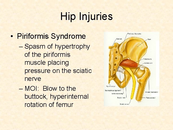 Hip Injuries • Piriformis Syndrome – Spasm of hypertrophy of the piriformis muscle placing
