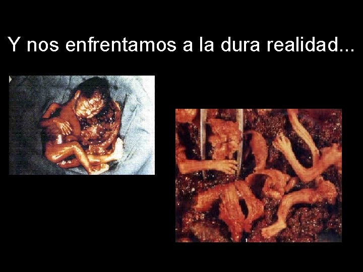 Y nos enfrentamos a la dura realidad. . . 