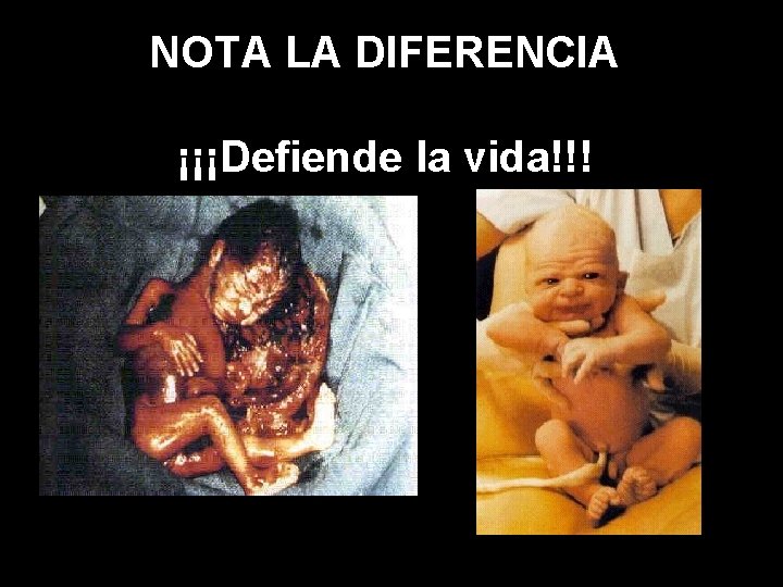 NOTA LA DIFERENCIA ¡¡¡Defiende la vida!!! 