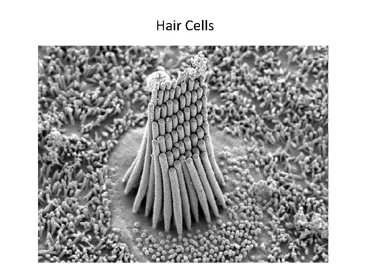 Hair Cells 