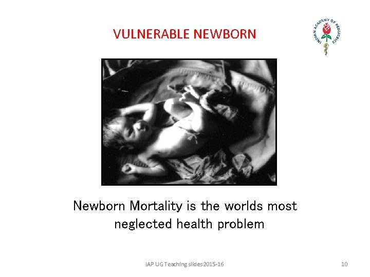 VULNERABLE NEWBORN Newborn Mortality is the worlds most neglected health problem IAP UG Teaching