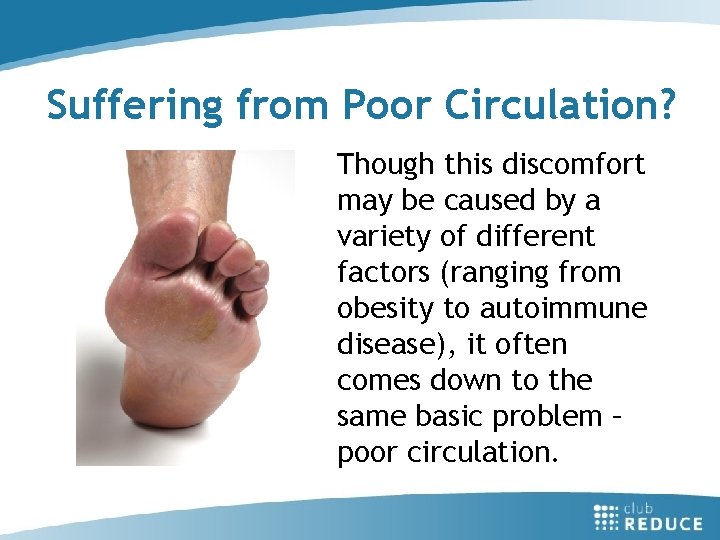 Suffering from Poor Circulation? Though this discomfort may be caused by a variety of