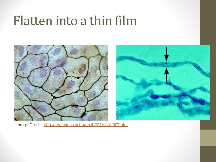 Flatten into a thin film Image Credits http: //anatomia. uw. hu/anat-007. htm 