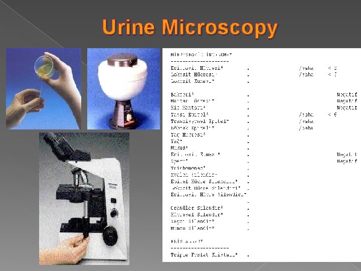 Urine Microscopy 
