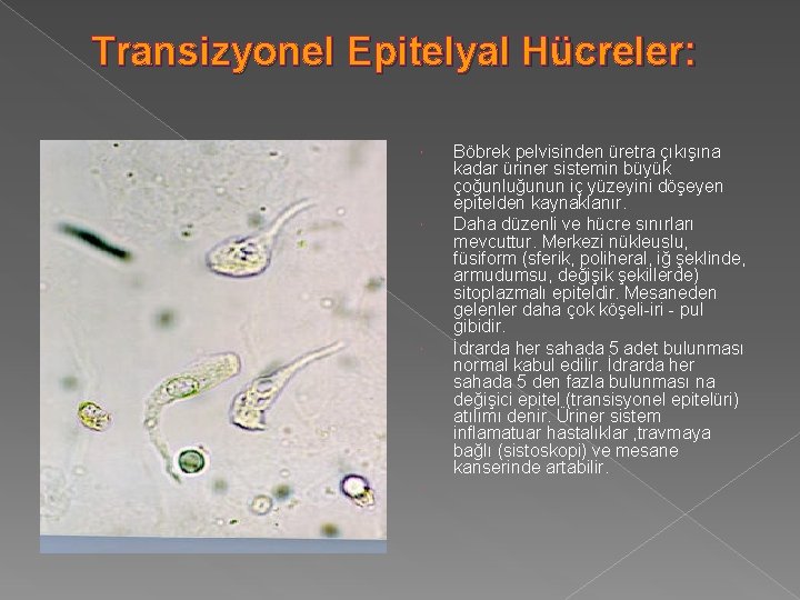 Transizyonel Epitelyal Hücreler: Böbrek pelvisinden üretra çıkışına kadar üriner sistemin büyük çoğunluğunun iç yüzeyini