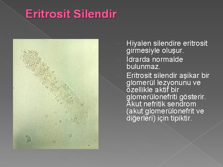 Eritrosit Silendir Hiyalen silendire eritrosit girmesiyle oluşur. İdrarda normalde bulunmaz. Eritrosit silendir aşikar bir