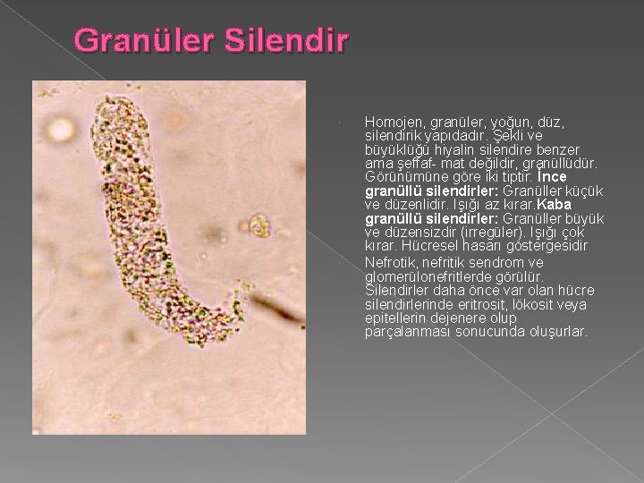 Granüler Silendir Homojen, granüler, yoğun, düz, silendirik yapıdadır. Şekli ve büyüklüğü hiyalin silendire benzer