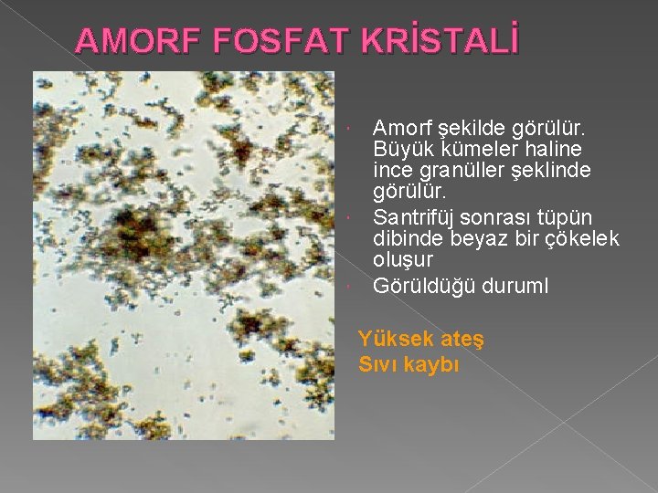 AMORF FOSFAT KRİSTALİ Amorf şekilde görülür. Büyük kümeler haline ince granüller şeklinde görülür. Santrifüj