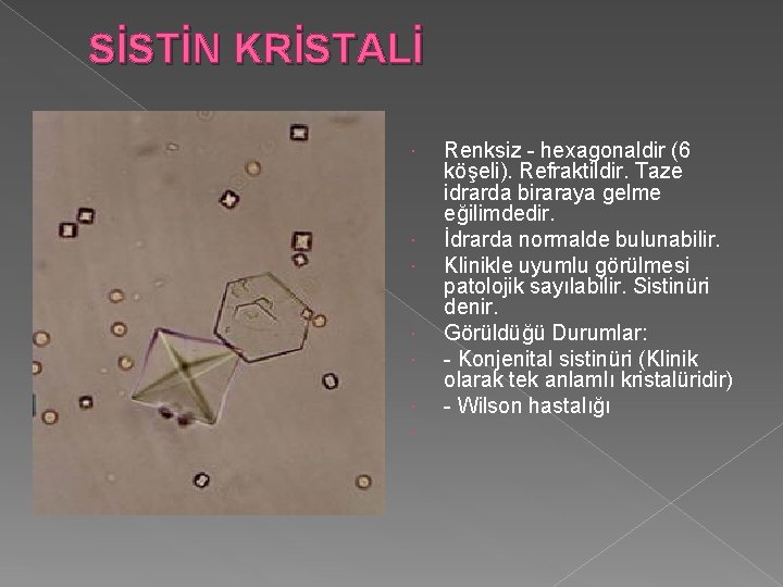 SİSTİN KRİSTALİ Renksiz - hexagonaldir (6 köşeli). Refraktildir. Taze idrarda biraraya gelme eğilimdedir. İdrarda