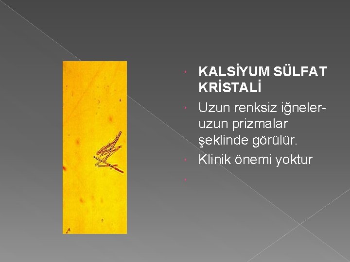 KALSİYUM SÜLFAT KRİSTALİ Uzun renksiz iğneleruzun prizmalar şeklinde görülür. Klinik önemi yoktur 