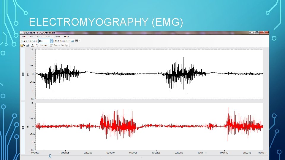 ELECTROMYOGRAPHY (EMG) 