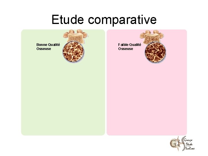 Etude comparative Bonne Qualité Osseuse Faible Qualité Osseuse 