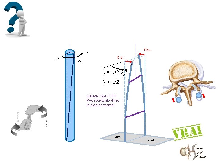 Flex. Ext. = /2. 2 < /2 Liaison Tige / DTT: Peu résistante dans