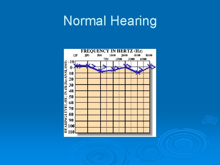 Normal Hearing 