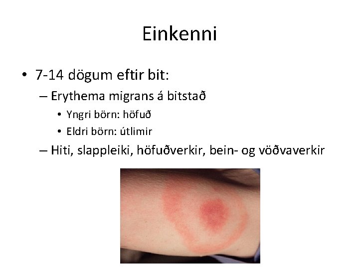 Einkenni • 7 -14 dögum eftir bit: – Erythema migrans á bitstað • Yngri