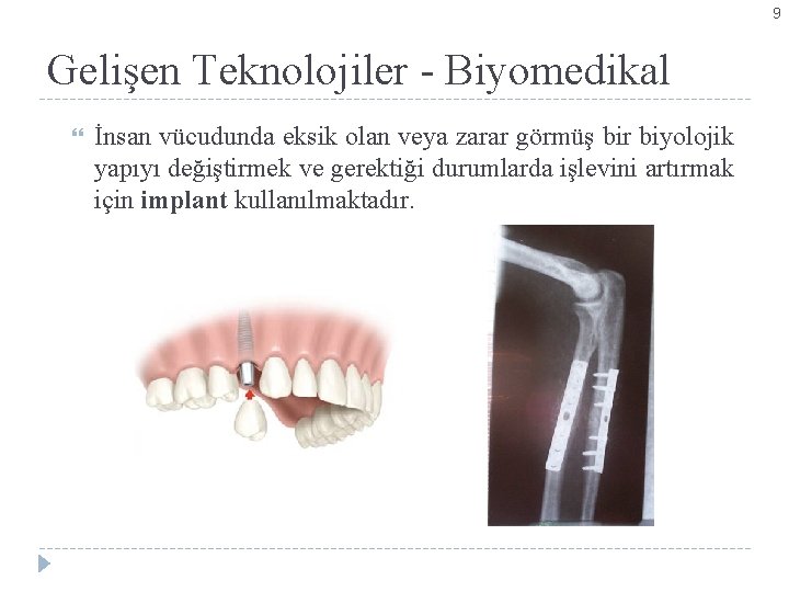 9 Gelişen Teknolojiler - Biyomedikal İnsan vücudunda eksik olan veya zarar görmüş bir biyolojik