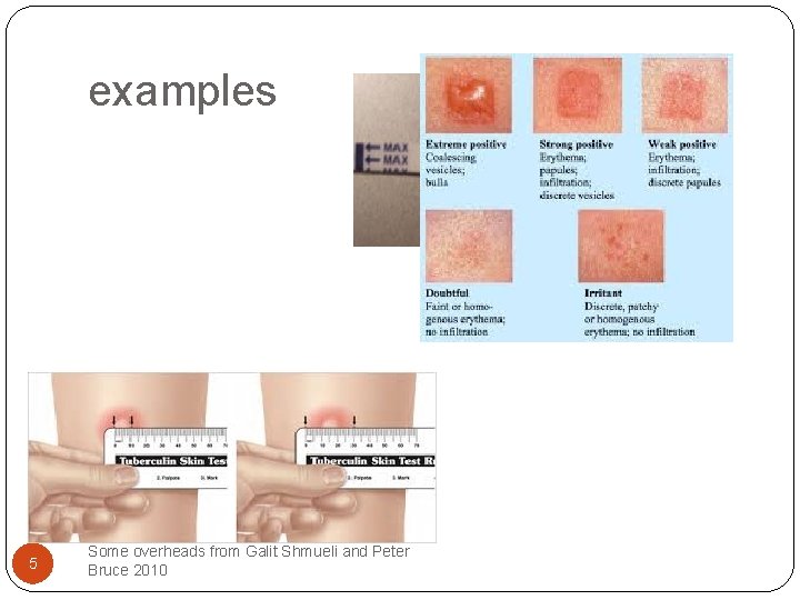 examples 5 Some overheads from Galit Shmueli and Peter Bruce 2010 