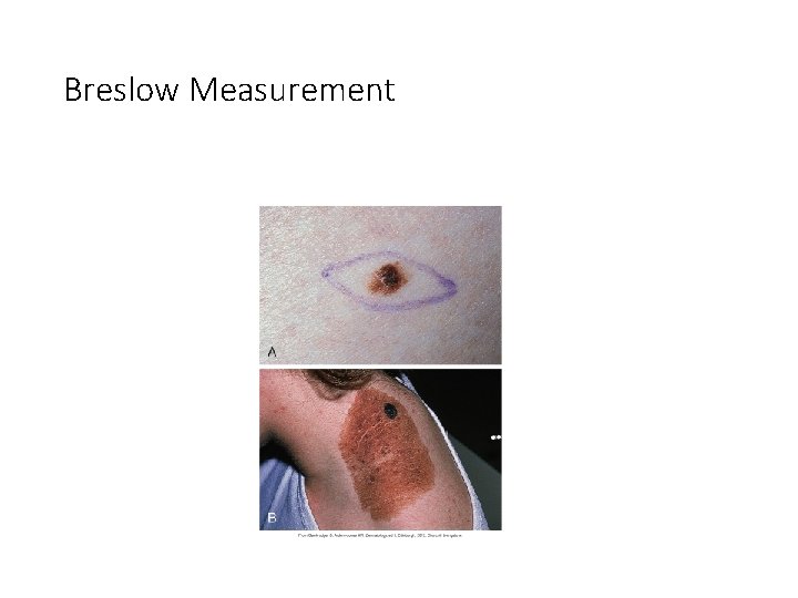 Skin Cancer And Other Skin Problems Chapter 23 skin-cancer-and-other-skin-problems-chapter-23