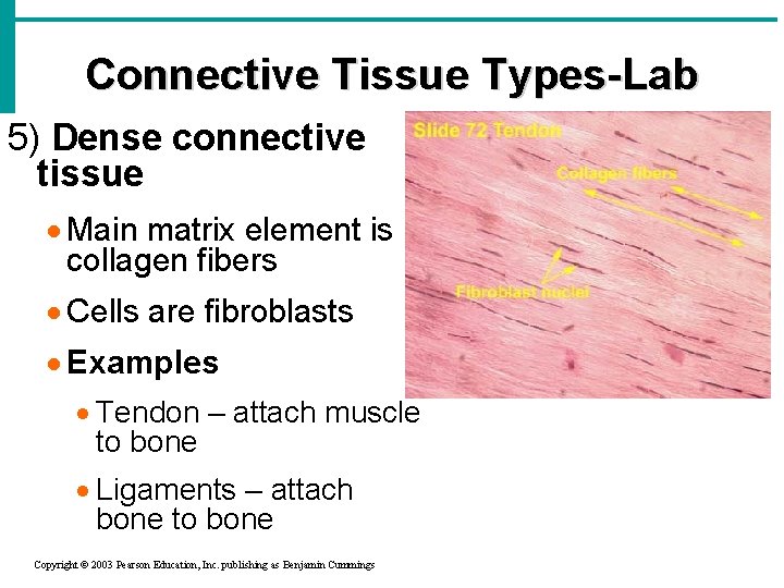 Connective Tissue Types-Lab 5) Dense connective tissue · Main matrix element is collagen fibers